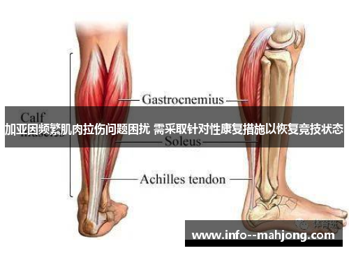 加亚因频繁肌肉拉伤问题困扰 需采取针对性康复措施以恢复竞技状态